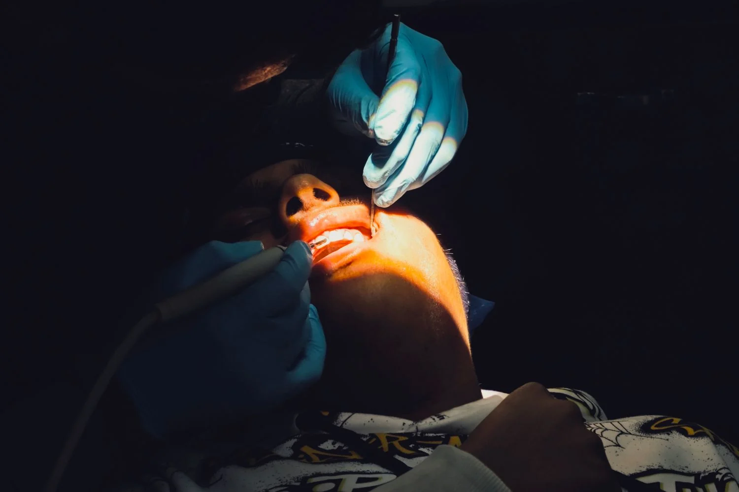 Sedation Dentistry at JP Dental, Perambur